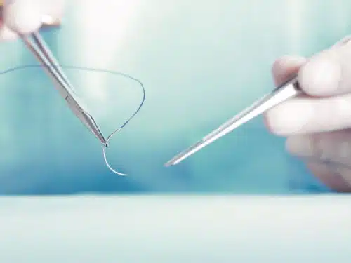 Plymouth Meeting’s ECRI Institute Explains Importance of Suture Types in New Report