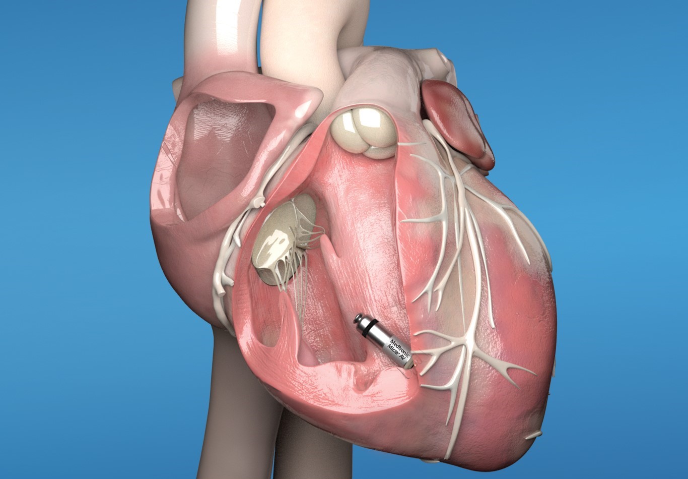 Heart