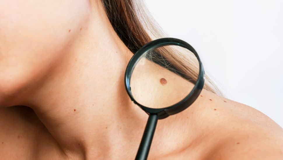 Mole on a woman's shoulder.