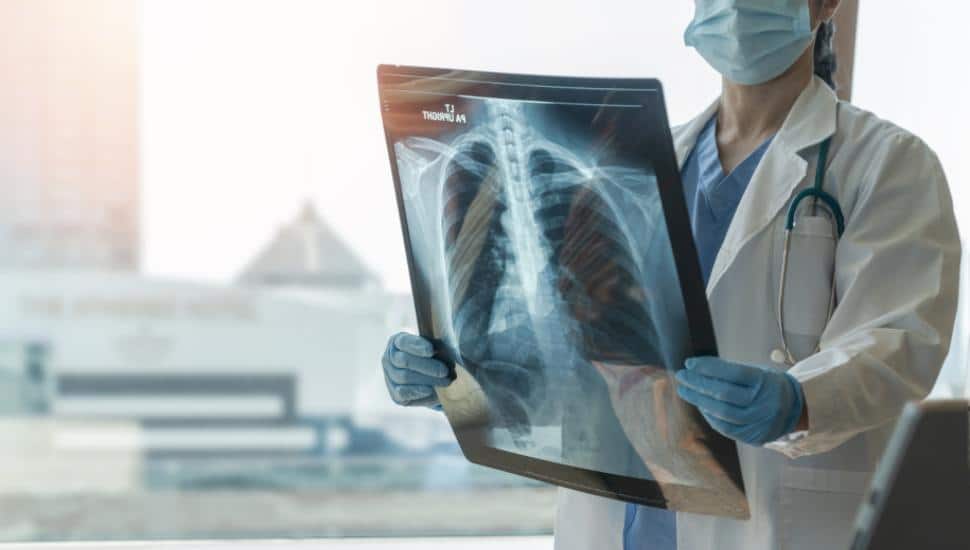 Doctor diagnoses patient’s health with radiological chest x-ray.