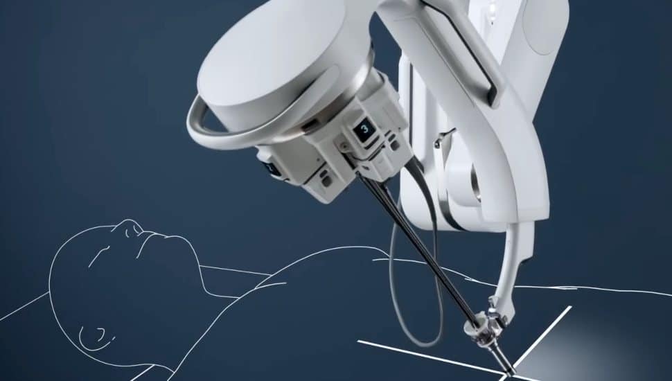 A simulation of the robotic surgery equipment making an incision.